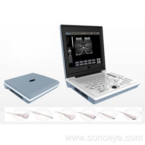 Laptop ultrasound machine with good quality